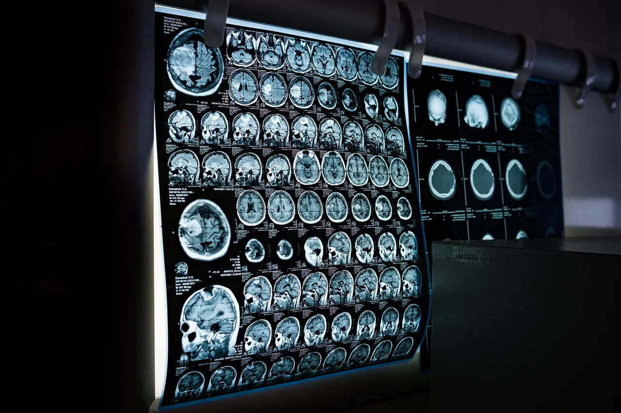 Imágenes médicas de resonancia